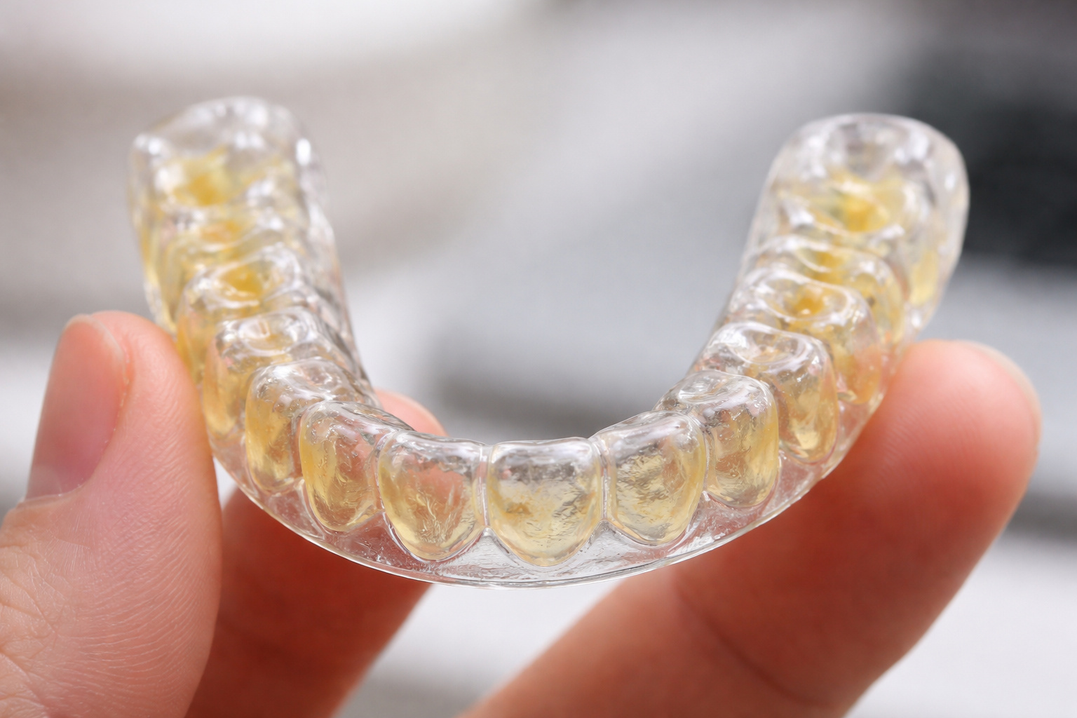 Why Is My Retainer Turning Yellow? Cleaning & Care
